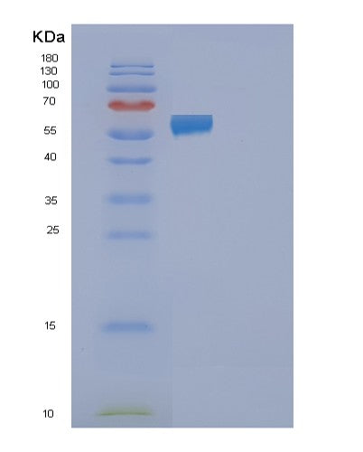 Human FAAH2 (Fatty-Acid Amide Hydrolase 2) - Recombinant Protein