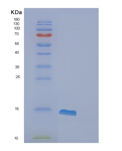 Human FABP6 (Gastrotropin) - Recombinant Protein