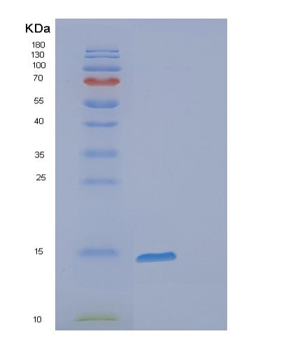 Human FABP7 (Fatty Acid-Binding Protein, Brain) - Recombinant Protein