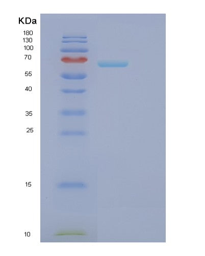 Human FARSB (Phenylalanine--Trna Ligase Beta Subunit) - Recombinant Protein