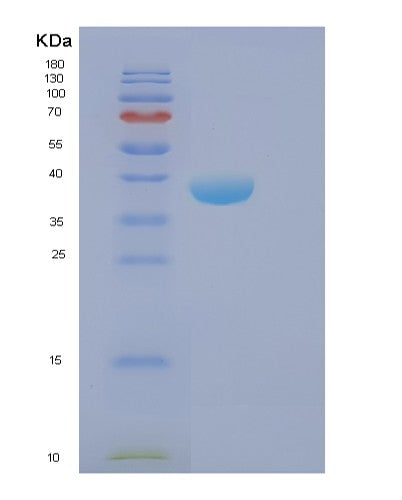 Human FBP2 (Fructose-1,6-Bisphosphatase Isozyme 2) - Recombinant Protein