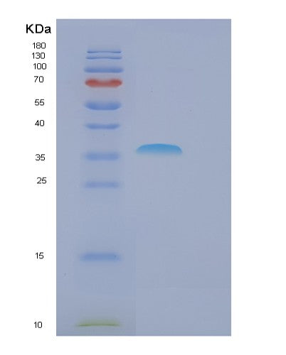Human FBXO6 (F-Box Only Protein 6) - Recombinant Protein