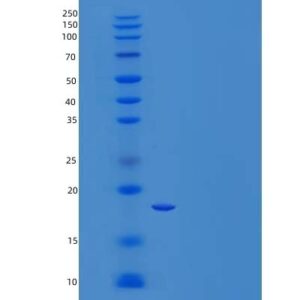 Human EIF5A2 (Eukaryotic Translation Initiation Factor 5A-2) - Recombinant Protein