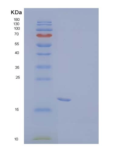 Human VAPB (Vesicle-Associated Membrane Protein-Associated Protein B/C) - Recombinant Protein