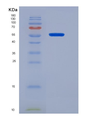 Human CD19 (B-Lymphocyte Antigen Cd19) - Recombinant Protein