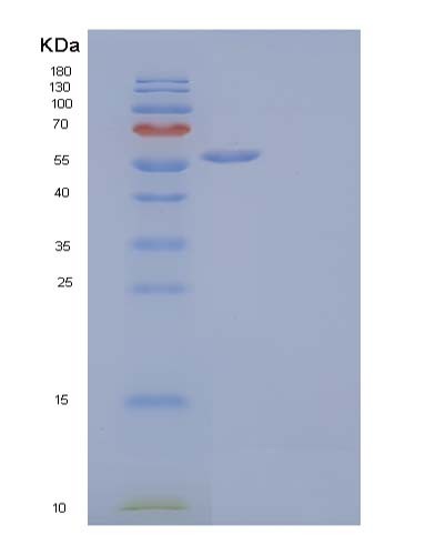 Human MICA (Mhc Class I Polypeptide-Related Sequence A) - Recombinant Protein