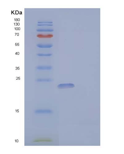 Human CSF3 (Granulocyte Colony-Stimulating Factor) - Recombinant Protein