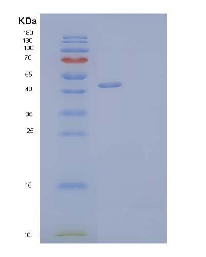 Human NTNG1 (Netrin-G1) - Recombinant Protein