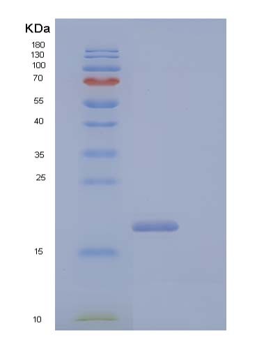 Human CD99L2 (Cd99 Antigen-Like Protein 2) - Recombinant Protein