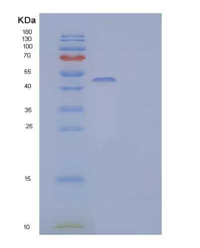 Human PNLIPRP2 (Pancreatic Lipase-Related Protein 2) - Recombinant Protein