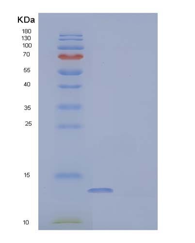 Human PVALB (Parvalbumin Alpha) - Recombinant Protein