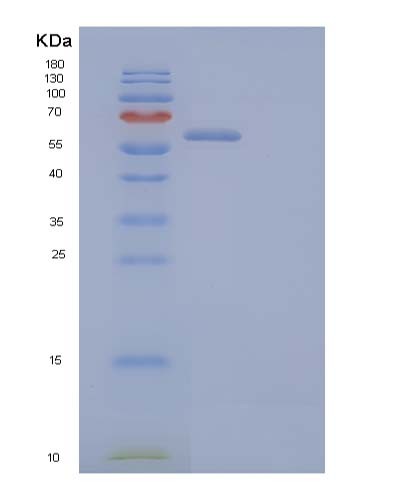 Human IGSF8 (Immunoglobulin Superfamily Member 8) - Recombinant Protein