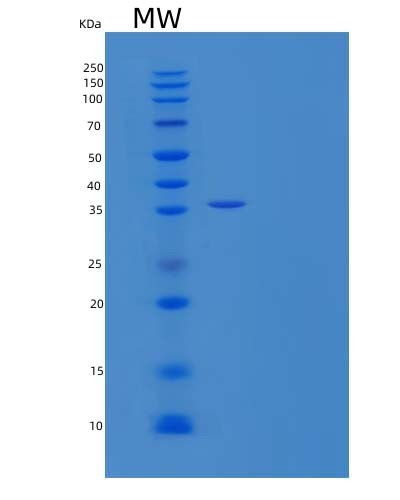 Human CALU (Calumenin) - Recombinant Protein