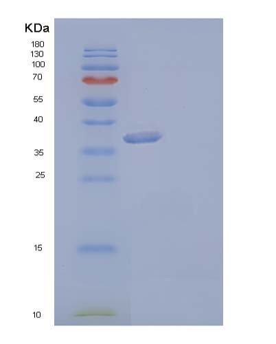 Human AKR1C3 (Aldo-Keto Reductase Family 1 Member C3) - Recombinant Protein