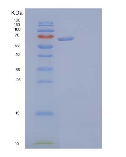 Human AFP (Alpha-Fetoprotein) - Recombinant Protein