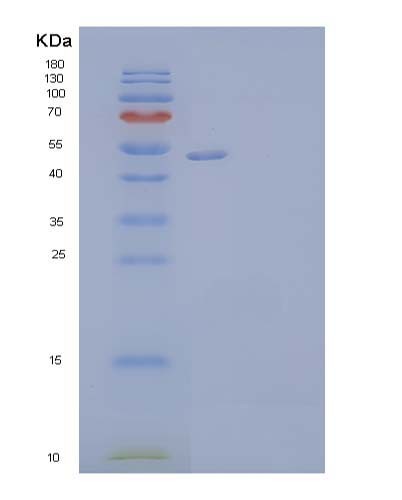 Human VTN (Vitronectin) - Recombinant Protein
