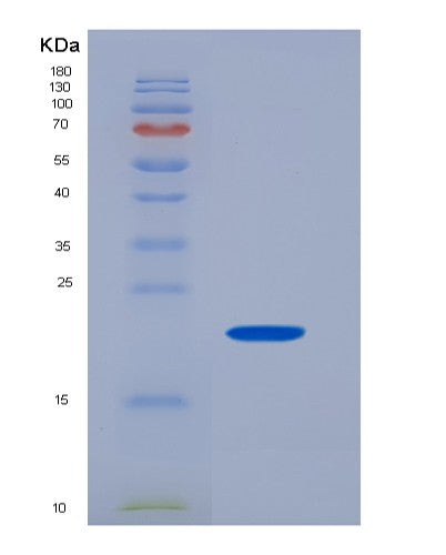 Human FCGR2A (Low Affinity Immunoglobulin Gamma Fc Region Receptor Ii-A) - Recombinant Protein