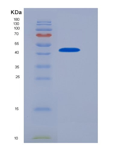 Human FCGR2A (Low Affinity Immunoglobulin Gamma Fc Region Receptor Ii-A) - Recombinant Protein