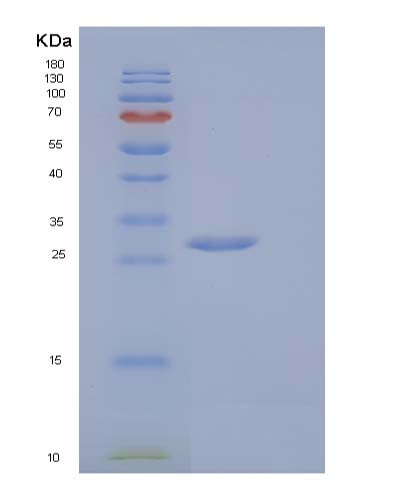 Mouse Vsig8 (V-Set And Immunoglobulin Domain-Containing Protein 8) - Recombinant Protein