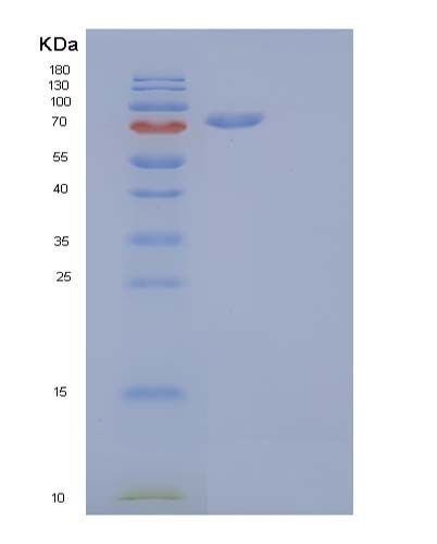 Human CDH16 (Cadherin-16) - Recombinant Protein