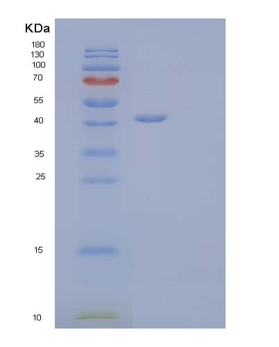 Human XCL1 (Lymphotactin) - Recombinant Protein