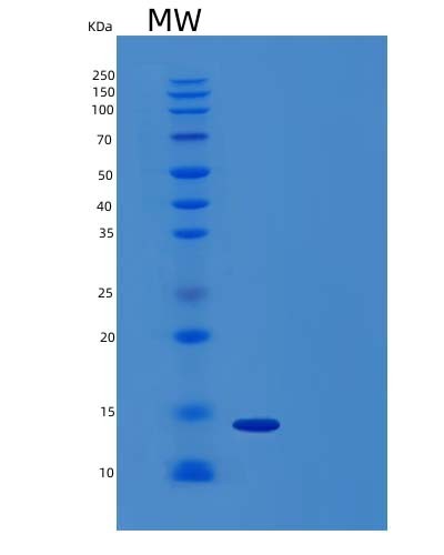 Human ACVR2B (Activin Receptor Type-2B) - Recombinant Protein