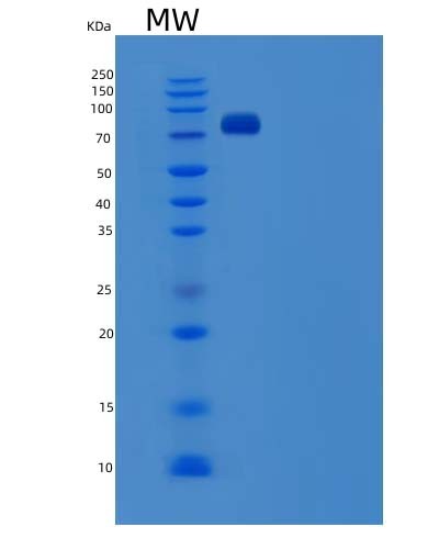 Human SCARB1 (Scavenger Receptor Class B Member 1) - Recombinant Protein