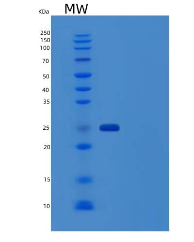 Human IGHG4 (Immunoglobulin Heavy Constant Gamma 4) - Recombinant Protein