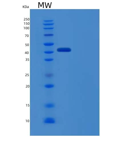 Human IFNAR1 (Interferon Alpha/Beta Receptor 1) - Recombinant Protein