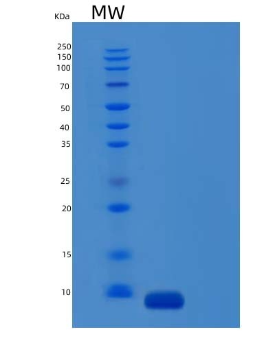 Mouse C5 (Complement C5) - Recombinant Protein