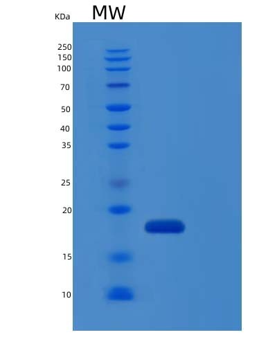 Human IL1RN (Interleukin-1 Receptor Antagonist Protein) - Recombinant Protein
