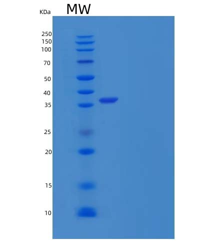 Human TALDO1 (Transaldolase) - Recombinant Protein