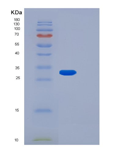 Human FGF14 (Fibroblast Growth Factor 14) - Recombinant Protein