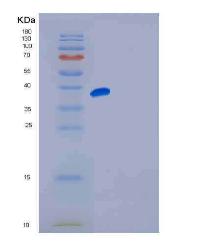 Human FGFR4 (Fibroblast Growth Factor Receptor 4) - Recombinant Protein