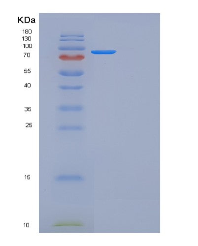 Mouse Folh1 (Glutamate Carboxypeptidase 2) - Recombinant Protein