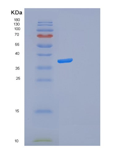 Human FOSL2 (Fos-Related Antigen 2) - Recombinant Protein
