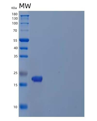 Human PDAP1 (28 Kda Heat- And Acid-Stable Phosphoprotein) - Recombinant Protein