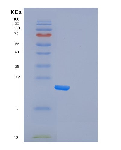 Human FXN (Frataxin, Mitochondrial) - Recombinant Protein