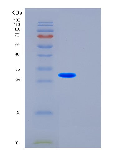 Human FST (Follistatin) - Recombinant Protein