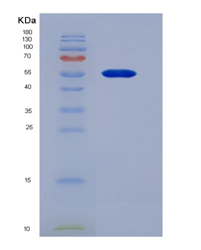 Human WARS1 (Tryptophan--Trna Ligase, Cytoplasmic) - Recombinant Protein