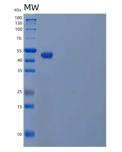 Human TUBB4A (Tubulin Beta-4A Chain) - Recombinant Protein