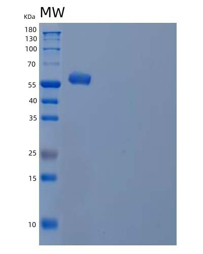 Human IRF5 (Interferon Regulatory Factor 5) - Recombinant Protein