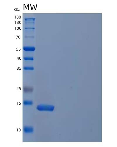 Mouse Il21 (Interleukin-21) - Recombinant Protein