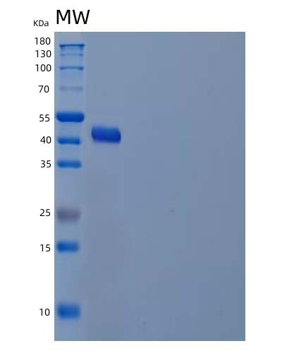 Human ADH7 (All-Trans-Retinol Dehydrogenase [Nad(+)] Adh7) - Recombinant Protein