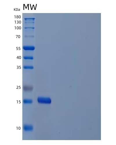 Human IL21 (Interleukin-21) - Recombinant Protein
