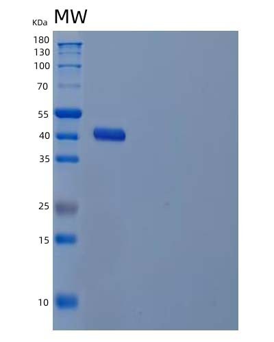 Human GALE (Udp-Glucose 4-Epimerase) - Recombinant Protein