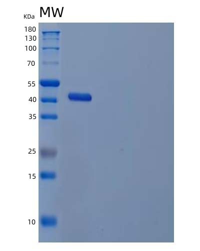 Human IL22 (Interleukin-22) - Recombinant Protein