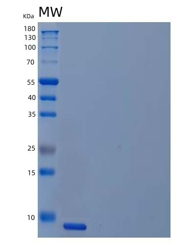 Human UCMA (Unique Cartilage Matrix-Associated Protein) - Recombinant Protein