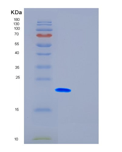 Human FTH1 (Ferritin Heavy Chain) - Recombinant Protein