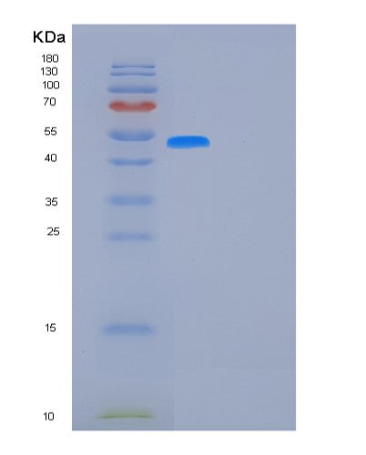 Human FUCA1 (Tissue Alpha-L-Fucosidase) - Recombinant Protein